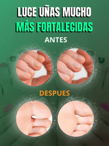 (TERBINAFINA) QUITA HONGOS EN LAS UÑAS